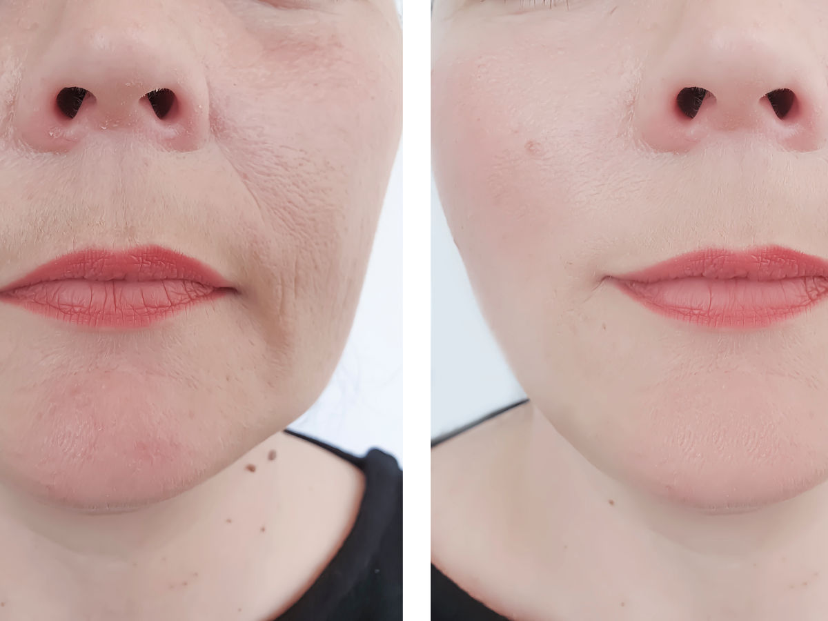 Skin quality example image