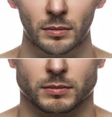 Natural aesthetic treatments for men in Maidenhead